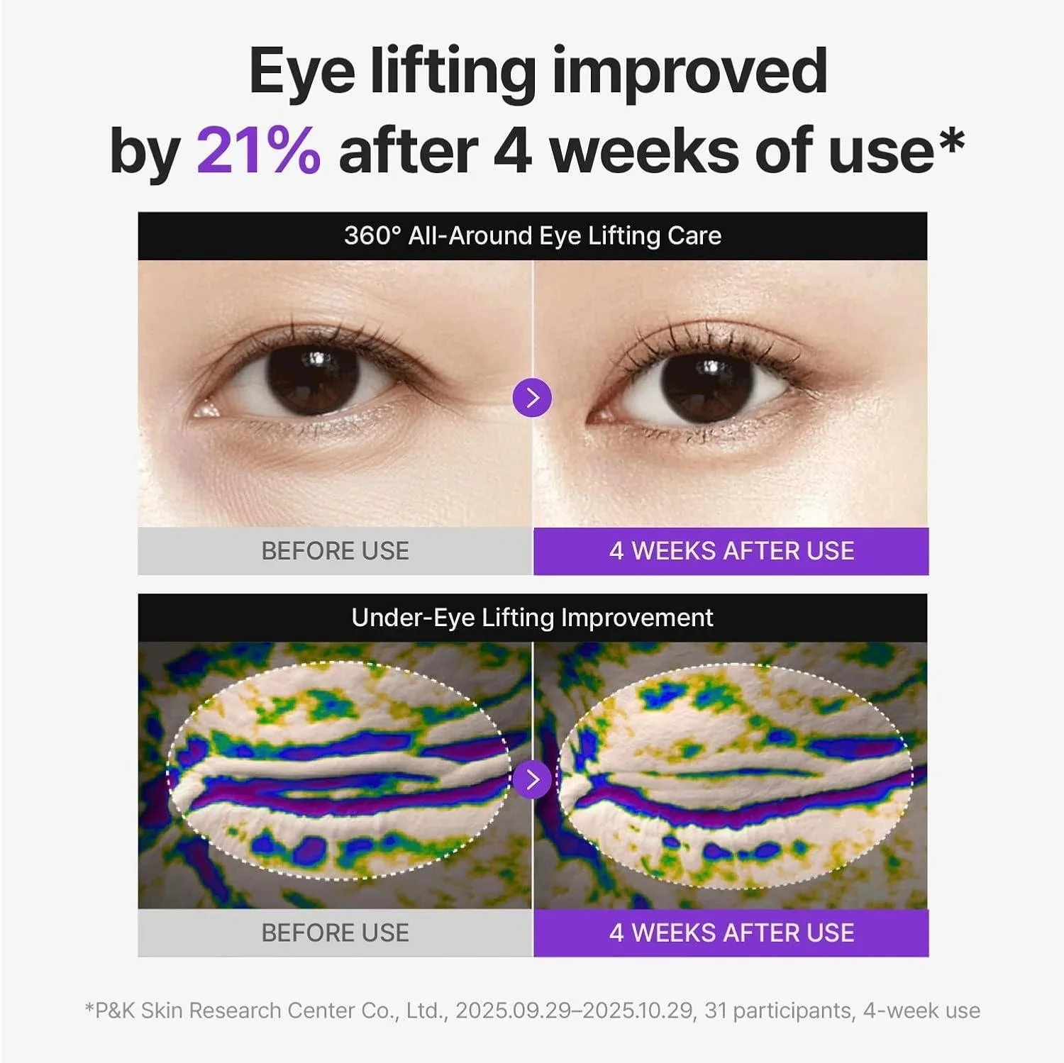 Centellian24 360 Shot PDRN Lifting Eye Cream 30ml - Image 5