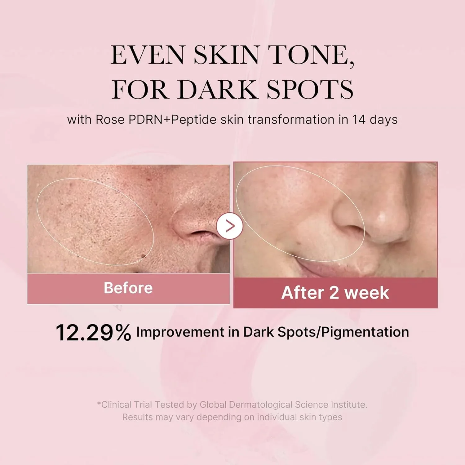 Medicube PDRN Pink Niacinamide Milky Toner 150ml - Image 3